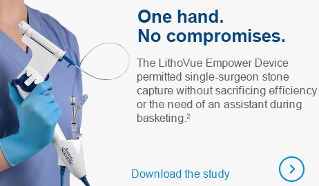 One Hand. No Compromises. The LithoVue Empower Device fits permitted single-surgeon stone capture without  sacrificing efficiency or the need  of an assistant during basketing. 2. View the published study.
