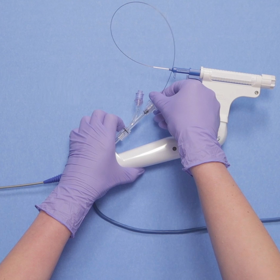 Watch a tutorial on how to setup the LithoVue Empower Device with the LithoVue™ Ureteroscope and our nitinol baskets.
