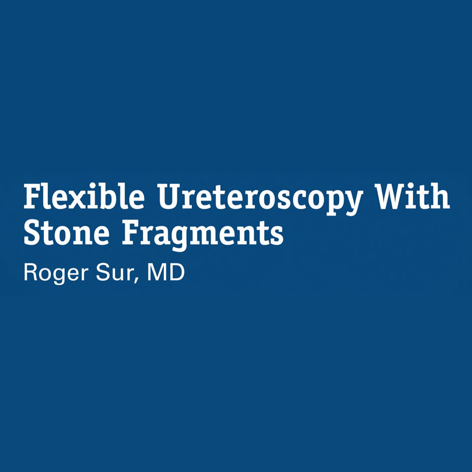 Ureteroscopia Flexível com Fragmentos de Cálculo