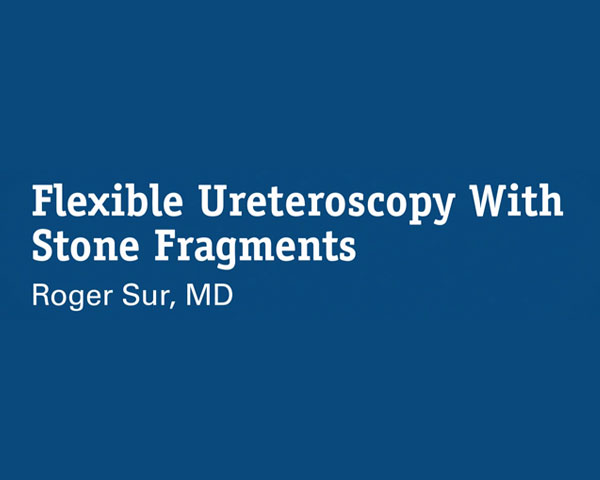 Ureteroscopia Flexível com Fragmentos de Cálculo