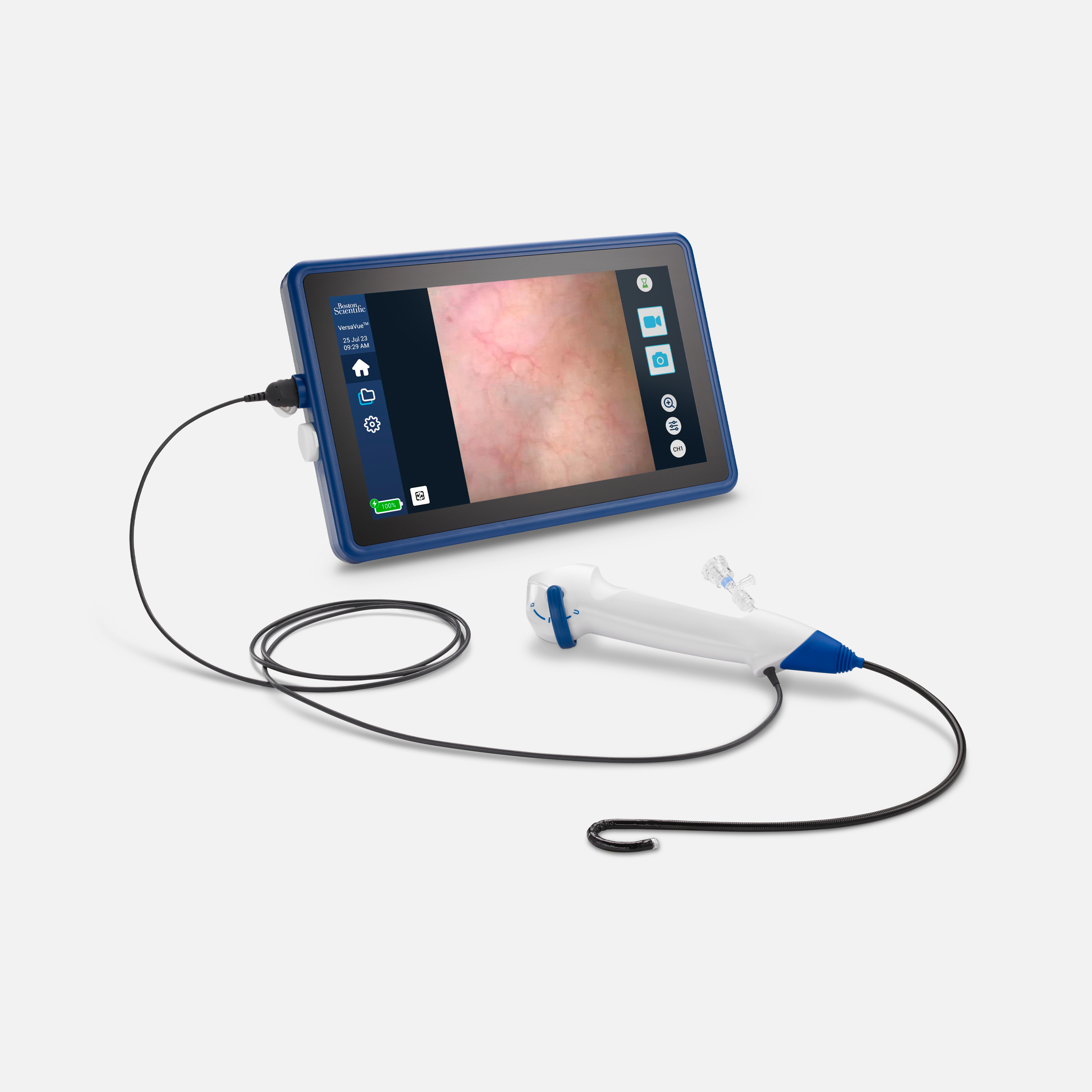 VersaVue tablet and cystoscope