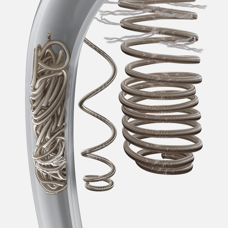 Embold™ Detachable Coil System: Three coils, any case