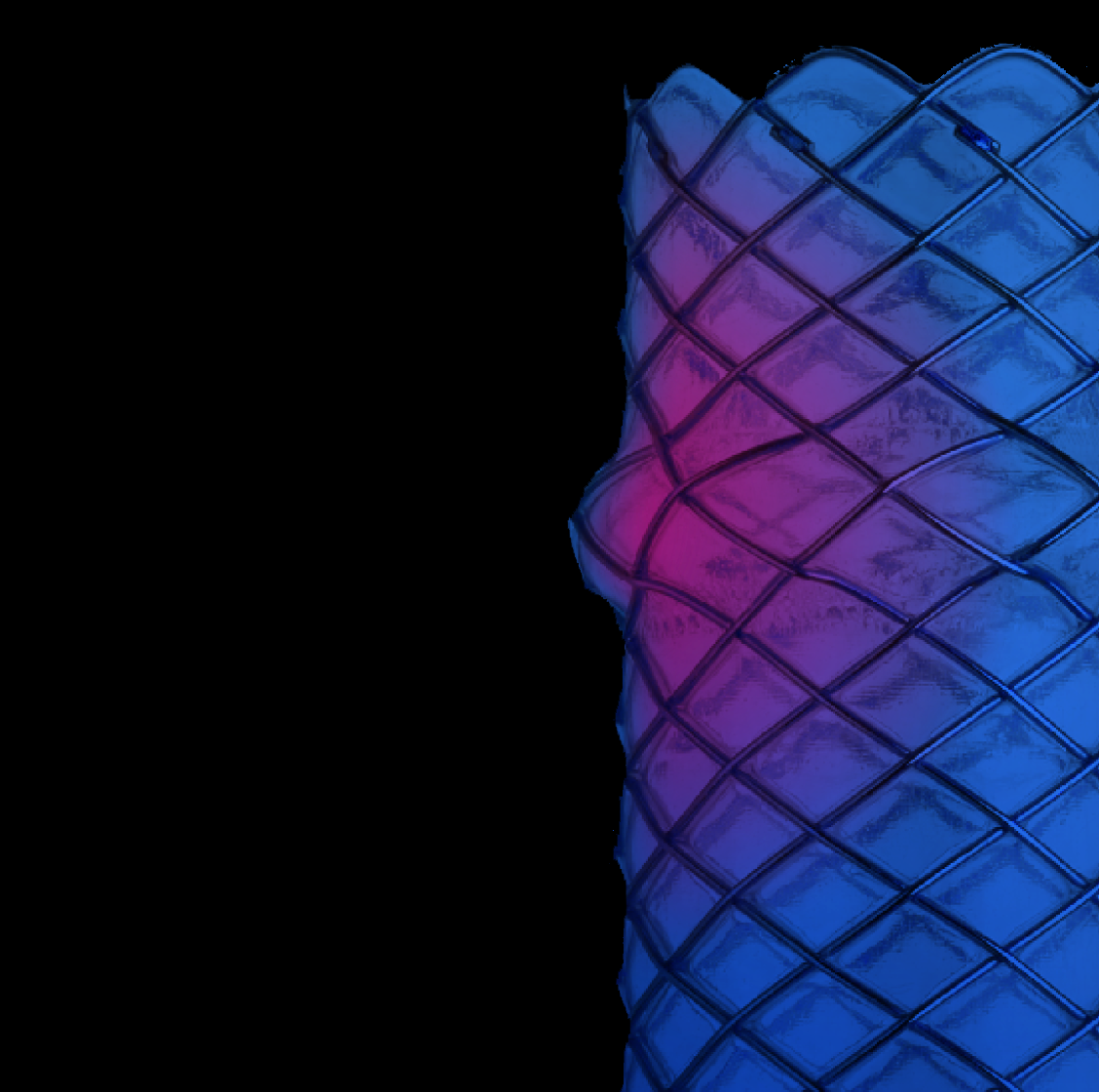 WallFlex Biliary PLUS Metal Stent with a highlighted anti-migration bump.