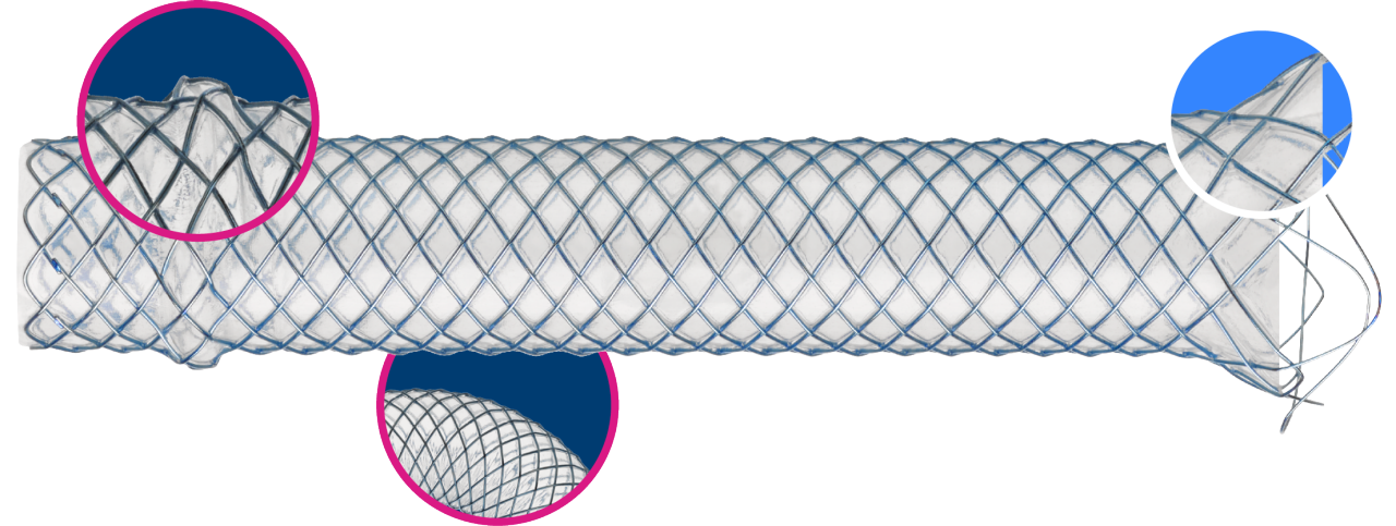 WallFlex Biliary PLUS Metal Stent.