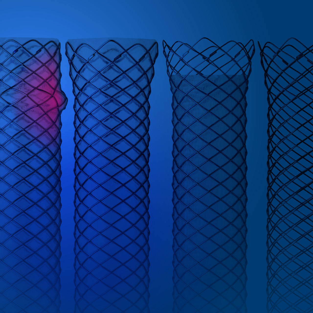 WallFlex Biliary Metal Stent portfolio highlighting all four different stents.