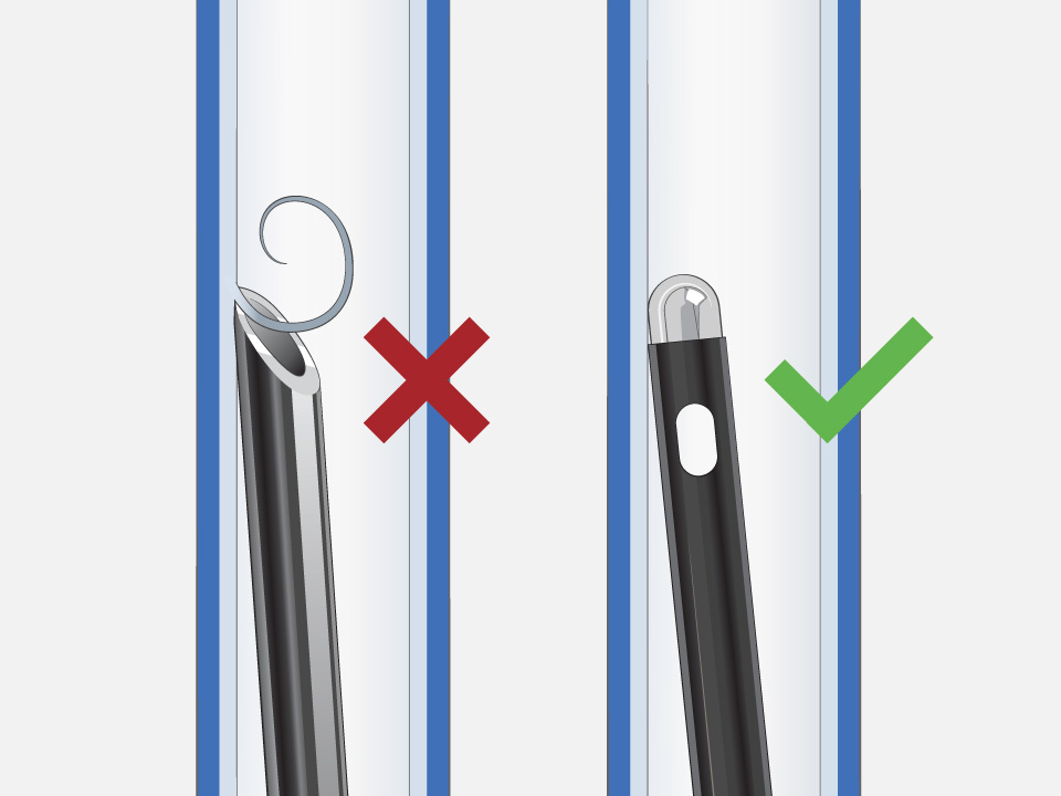 Transseptal Needle with skiving and red X, and NRG Transseptal Needle with no skiving, rounded tip, and green checkmark.