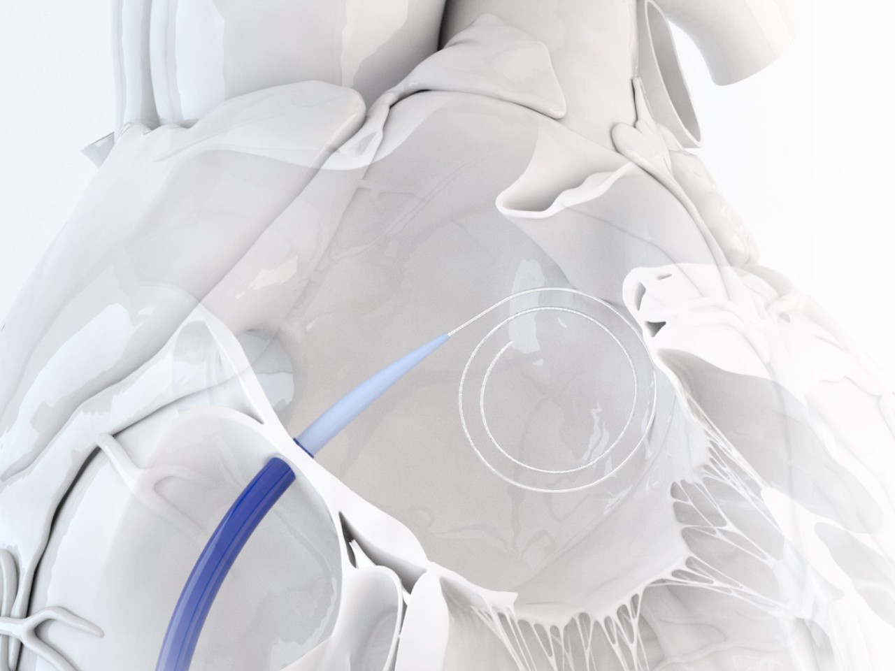 ProTrack Pigtail Wire cushioned against the left atrial wall.