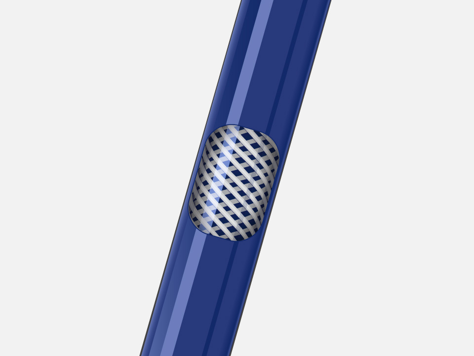 Detail of braided design inside VersaCross Steerable Sheath that helps offer controlled torque.