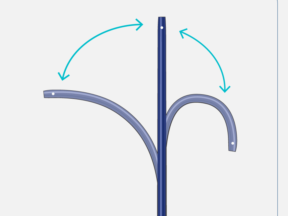 VersaCross Steerable Sheath positioned in multiple, bidirectional curve angles.
