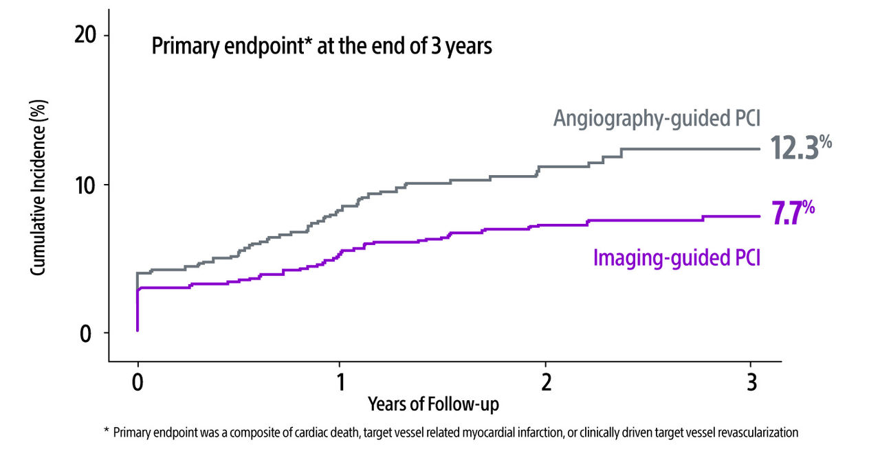 Graph showing lower TVF with imaging-guided PCI compared to Angiography-guided PCI