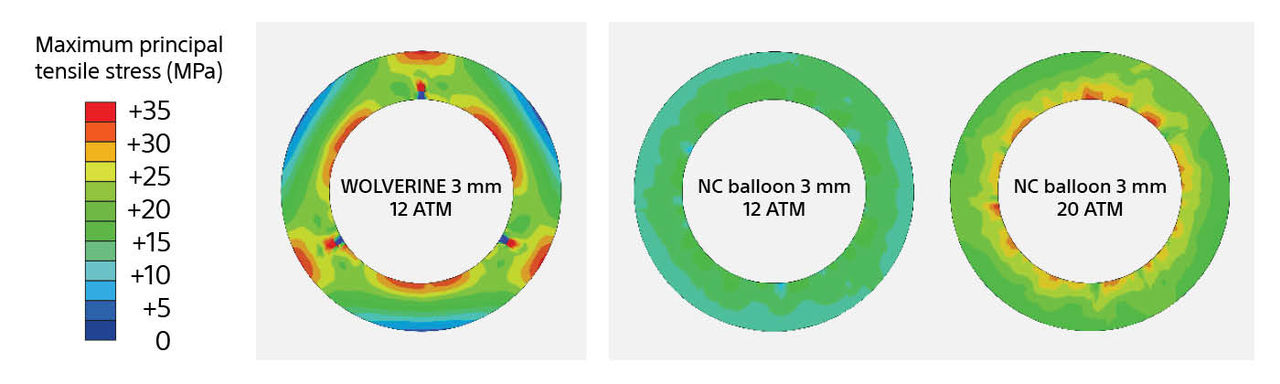 stress pressure test