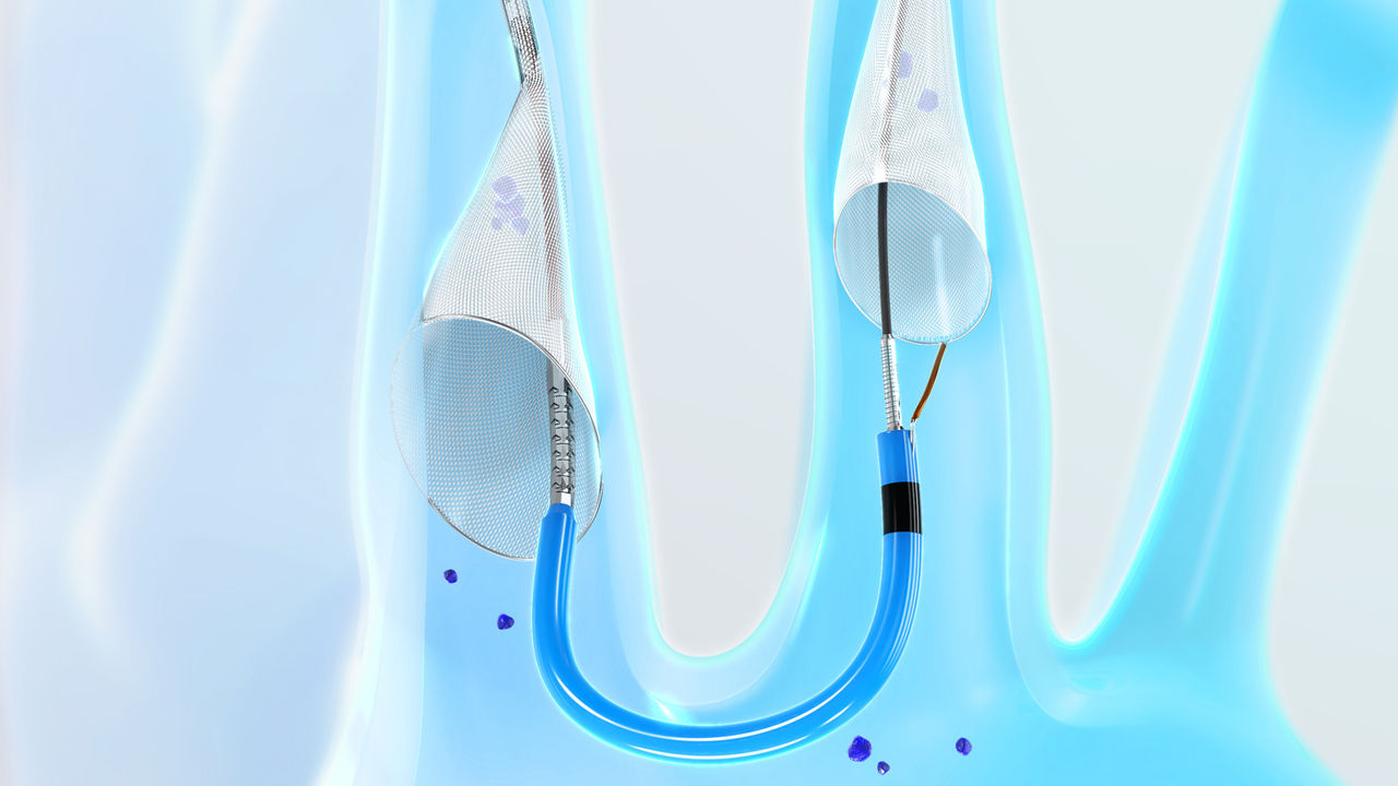 SENTINEL removing debris