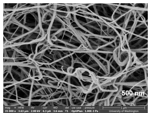 Fibrin after EKOS ultrasound.