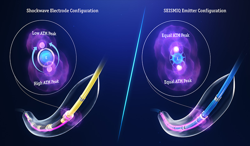 Shockwave electrode configuration vs SEISMIQ emitters configuration.