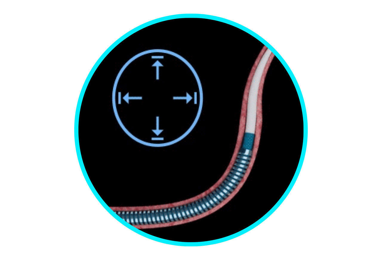 Catapult reinforced coil shaft technology.