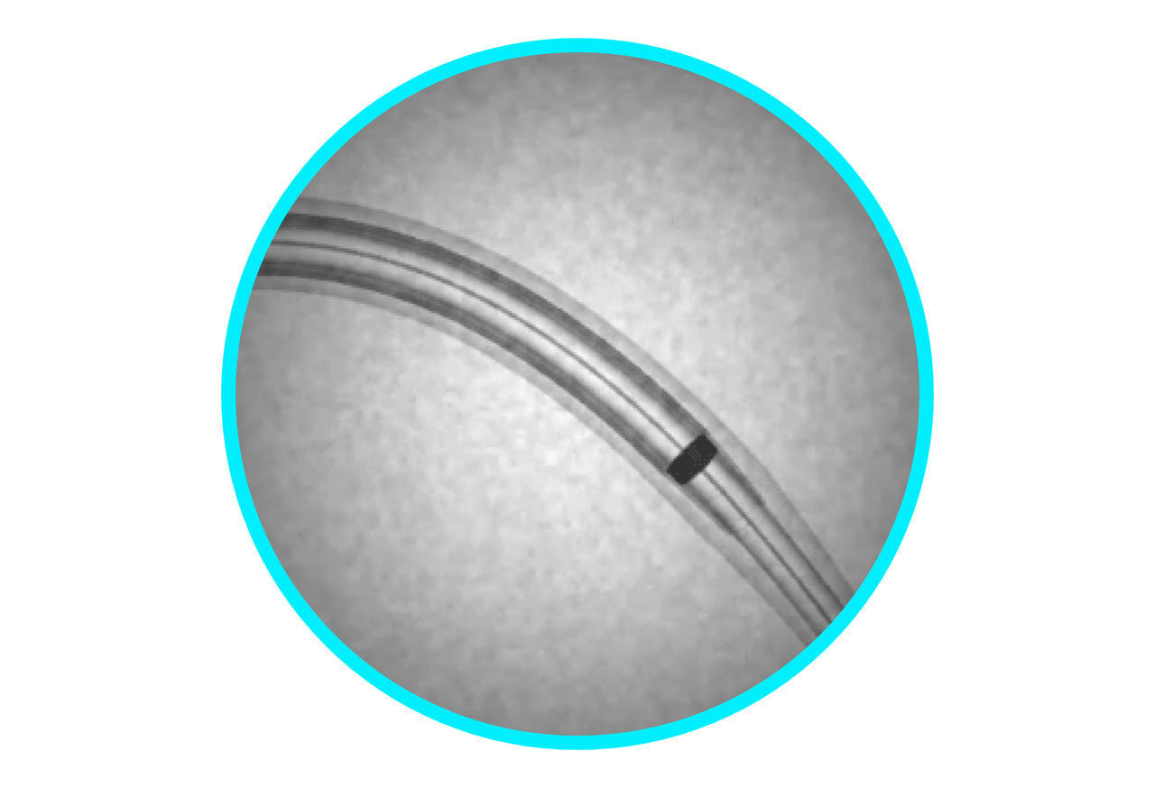 Platinum irridium marker.