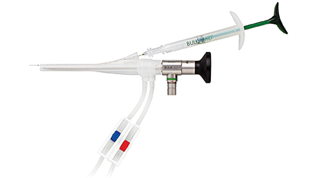 Bulkamid™ Urethral Bulking System product shot.