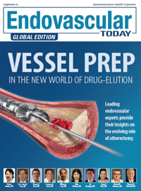 Descargar suplemento de EVT: preparación del vaso
