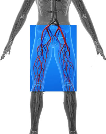 dvt-health-condition-location-345x435