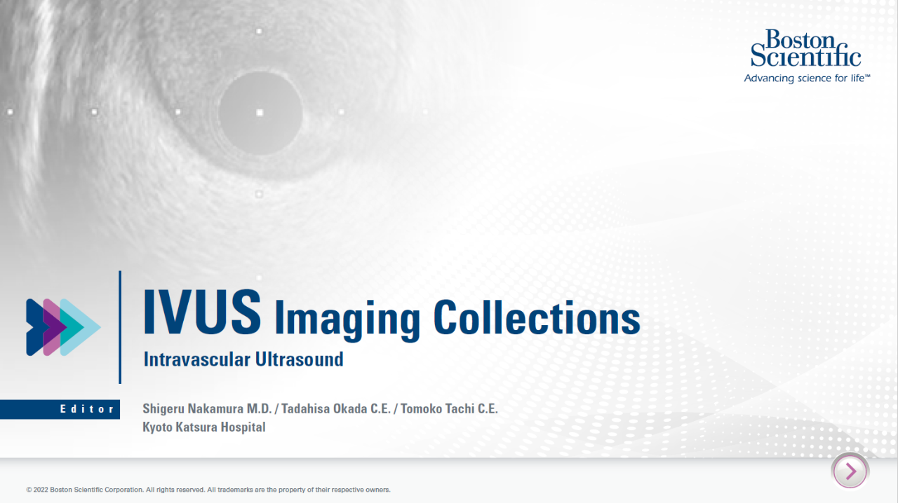 IVUS Imaging Collections​