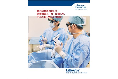 LithoVue™ 製品カタログ