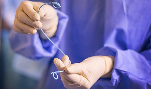 尿管ステント関連