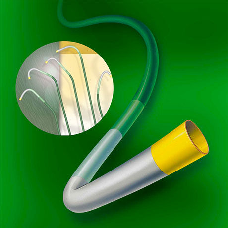 Mach 1™ Peripheral Guide Catheter