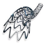 Arquitetura de Stent Personalizada