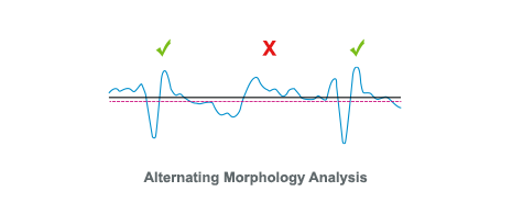 s-icd phase II certification algorithm