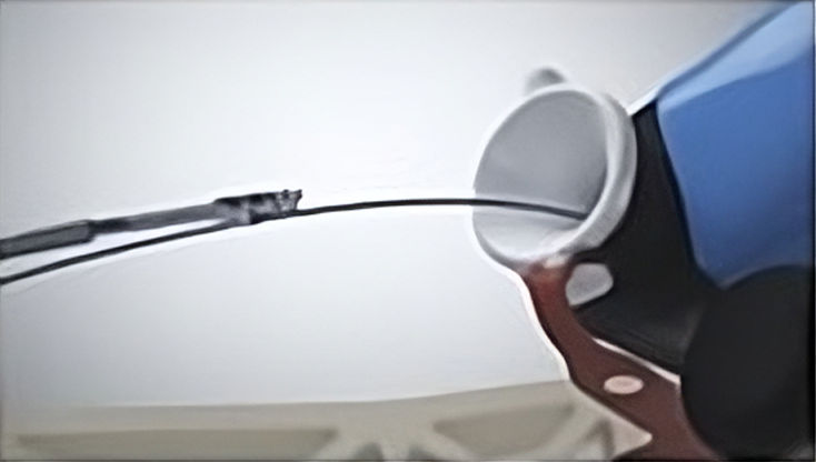 Foto de cierre del defecto