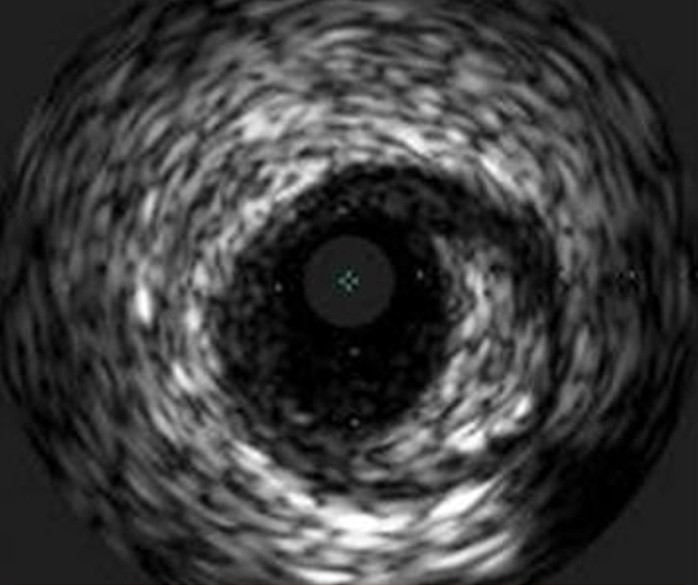 Eagle Eye Platinum 20 MHz