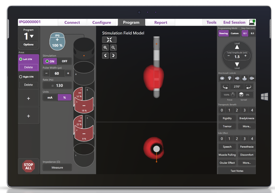 Extremo distal de Vercise Tist