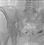 Descripción general de casos prácticos 5