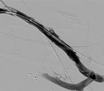 Descripción general de casos prácticos 11