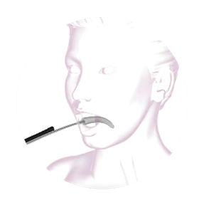 Orbera