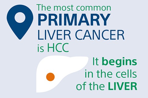 Primary liver cancer