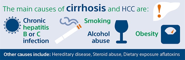 The main causes of cirrhosis and HCC