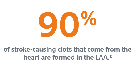 90% of stroke-causing clots that come from the heart are formed in the LAA.