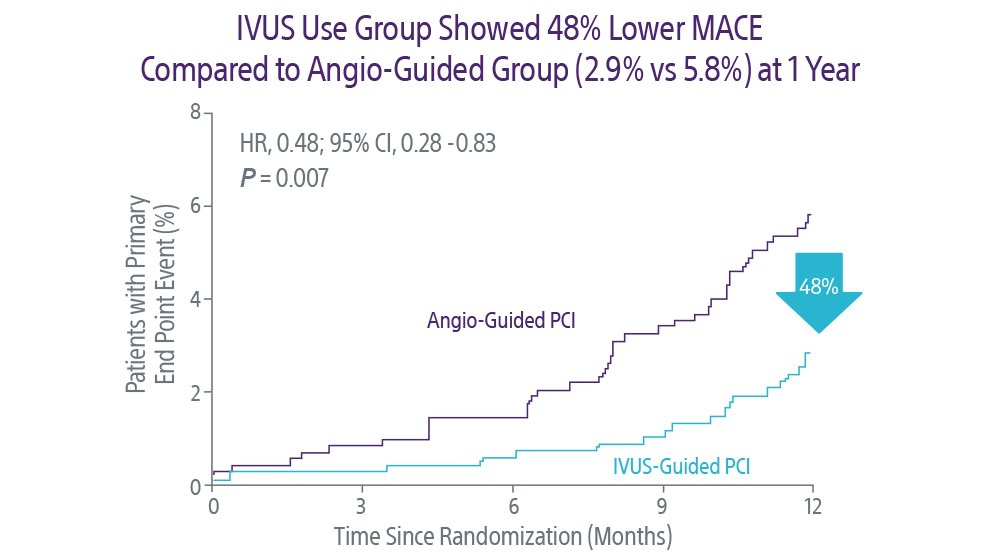 IVUS Use Group Showed 48% Lower MACE