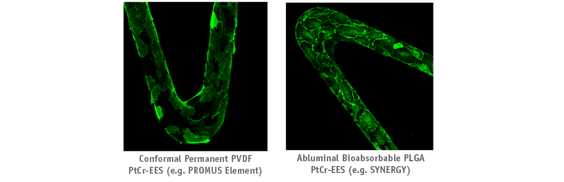 Endothelial Cell (EC) Function