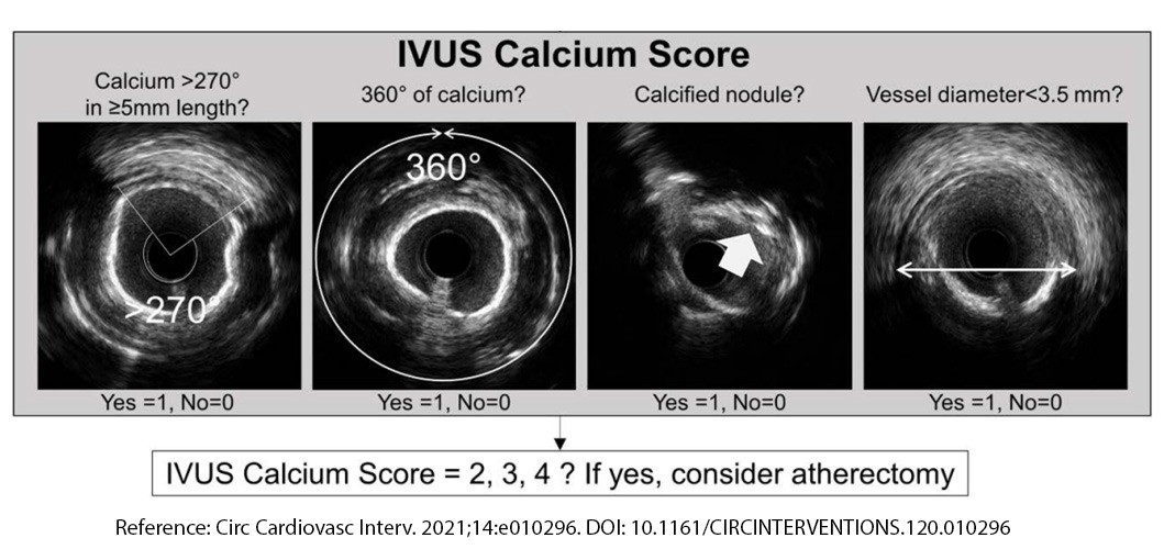 IVUS Calcium Score image