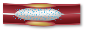A scientific drawing of AGENT DCB in a vessel illustrating rapid absorption. 