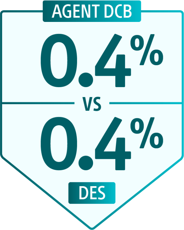 Myocardial infarction (MI)