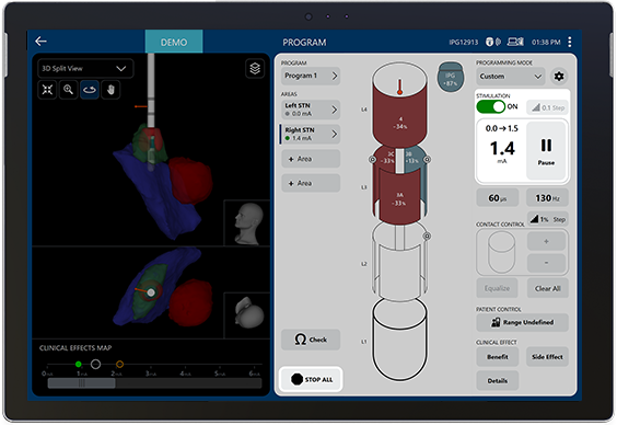 Tablet with Vercise Neural Navigator 5 Software showing a split screen of deep brain stimulation lead orientation and patient-specific program.