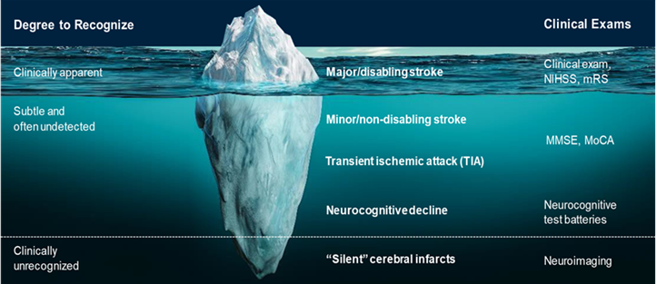 Iceberg showing related Stroke messages