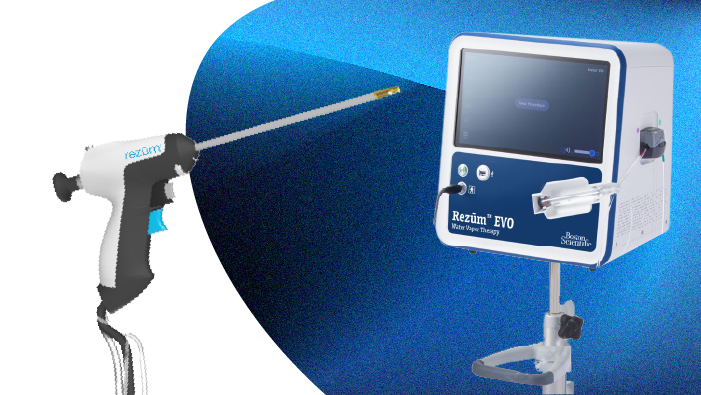 rezum water vapour therapy 