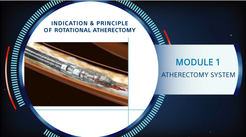 Atherectomy course video thumbnail