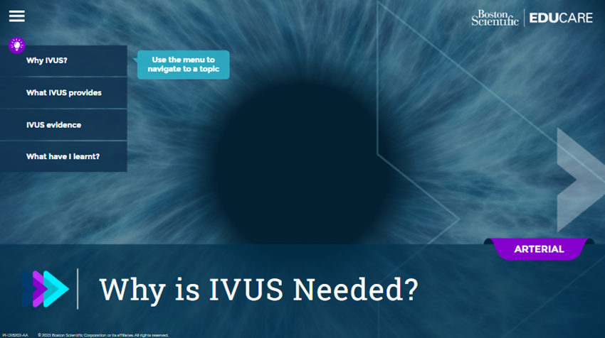 Why IVUS Needed video