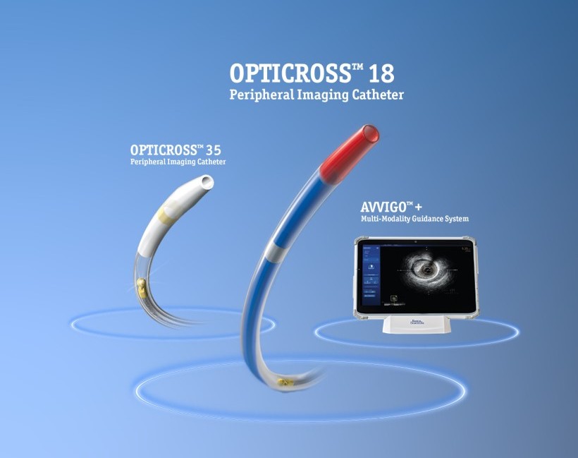 Vessel visualization portfolio products