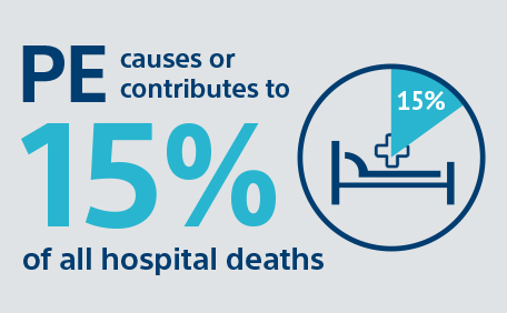 PE causes or contribues to 15% of all hospital deaths
